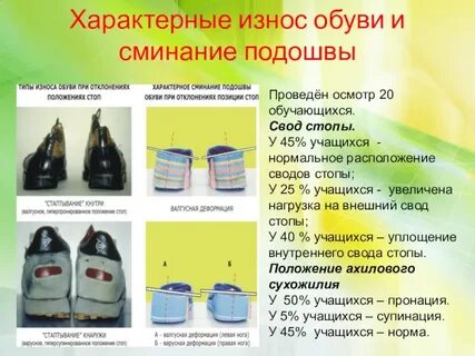 При длительном использовании подошва обуви изнашивается