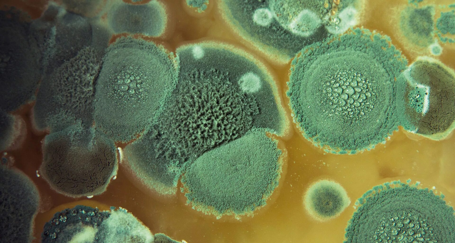 Aspergillus Niger под микроскопом. Aspergillus fumigatus споры. Aspergillus fumigatus колонии. Плесень Aspergillus fumigatus. Грибы споры в организме