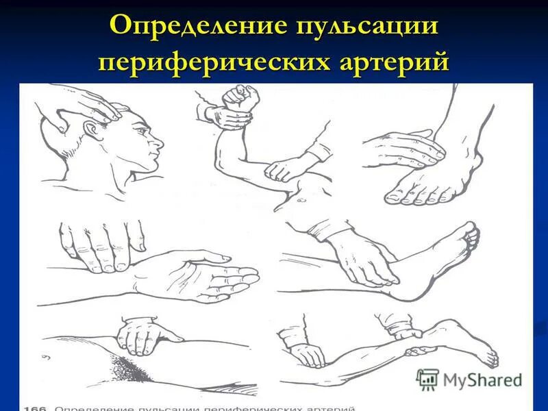 подсчет частоты пульса у детей. техника определения пульса. оценка и подсчет пульса алгоритм. исследование пульса на лучевой артерии алгоритм. техника определения пульса.