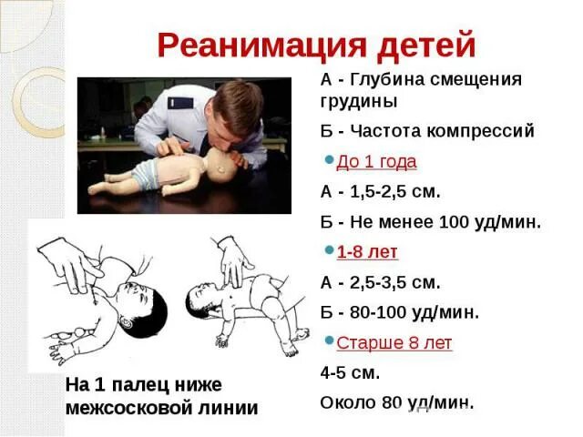 Соотношение дыханий и компрессий на грудину. Реанимация у детей частота компрессий. частота компрессий грудной клетки. реанимация соотношение компрессий у ребенка.