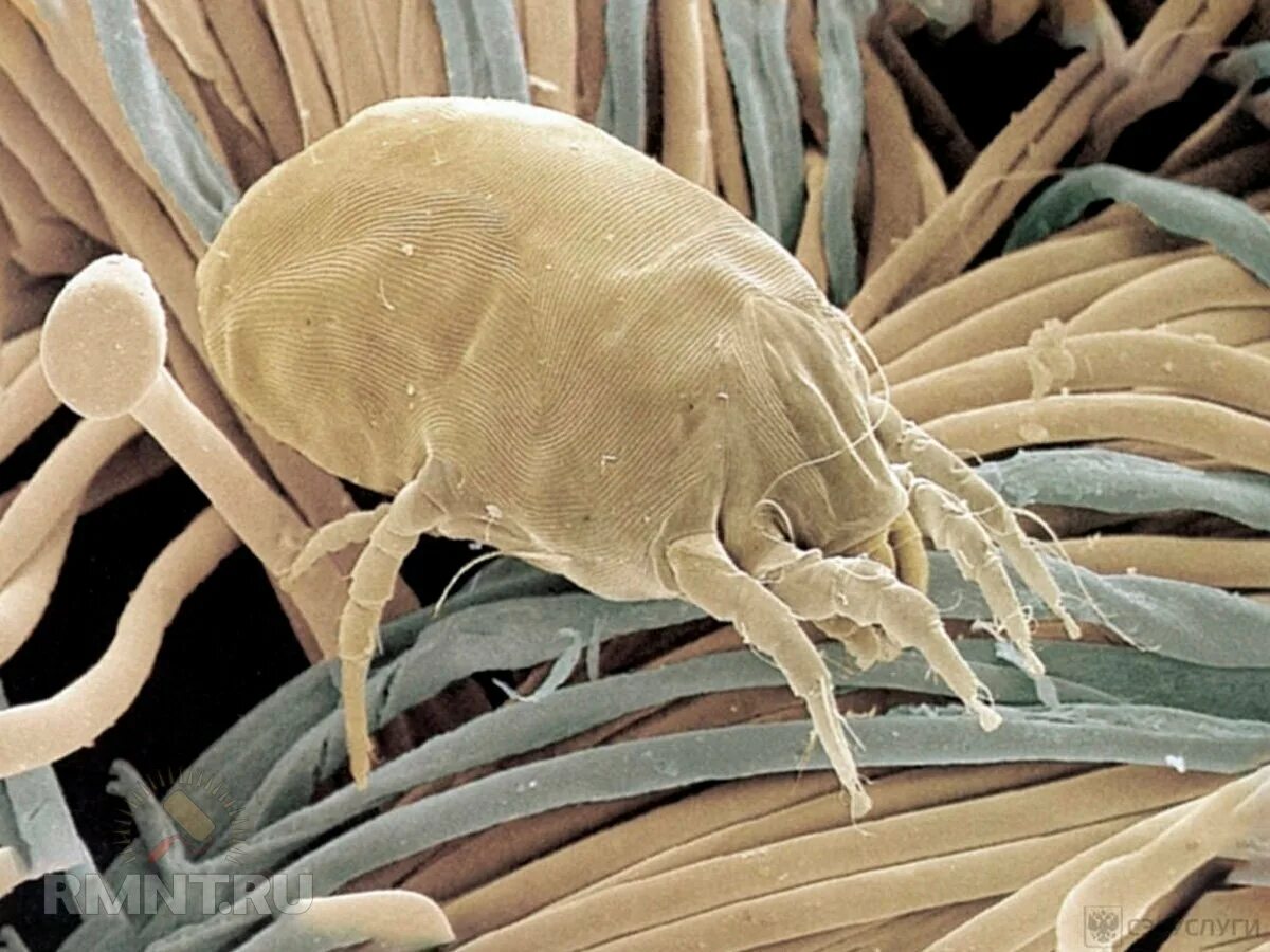 Аллергены клещей домашней пыли. Сапрофиты пылевые клещи. Клещ сапрофит под микроскопом. Пылевые клещи фото под микроскопом.