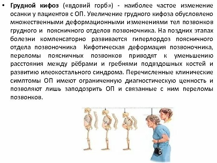 Грудной кифоз возникает в возрасте. Выраженный кифоз грудного отдела позвоночника. Грудной кифоз возникает в возрасте. Шейный лордоз образуется в возрасте. Грудной кифоз у грудного ребенка появляется в возрасте.