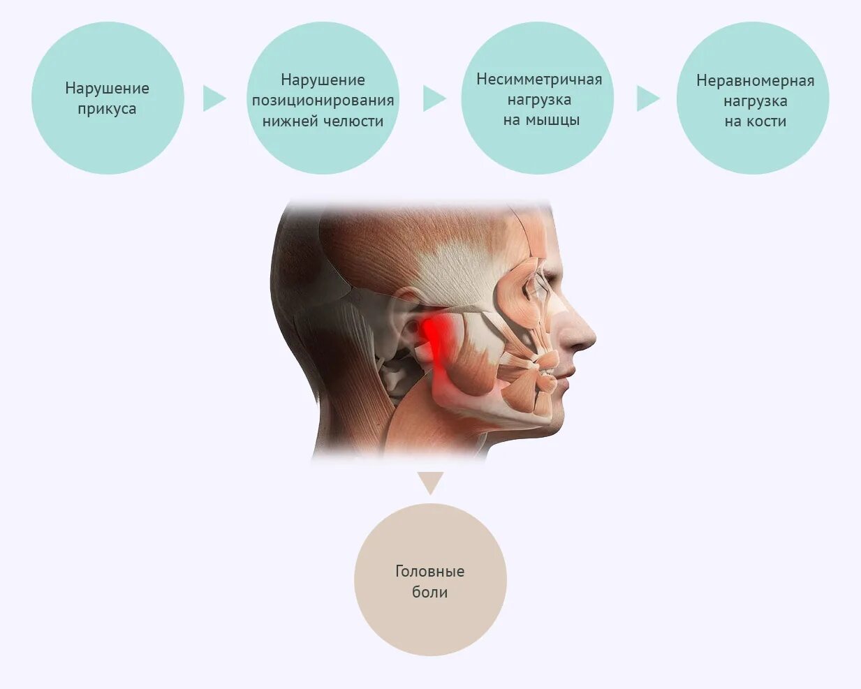 От чего может болеть челюсть. Дисфункция височно-нижнечелюстного сустава. Дисфункция височно-нижнечелюстного сустава (ВНЧС). Дисфункция височно верхнечелюстного сустава. Мышечно суставная дисфункция ВНЧС причины.