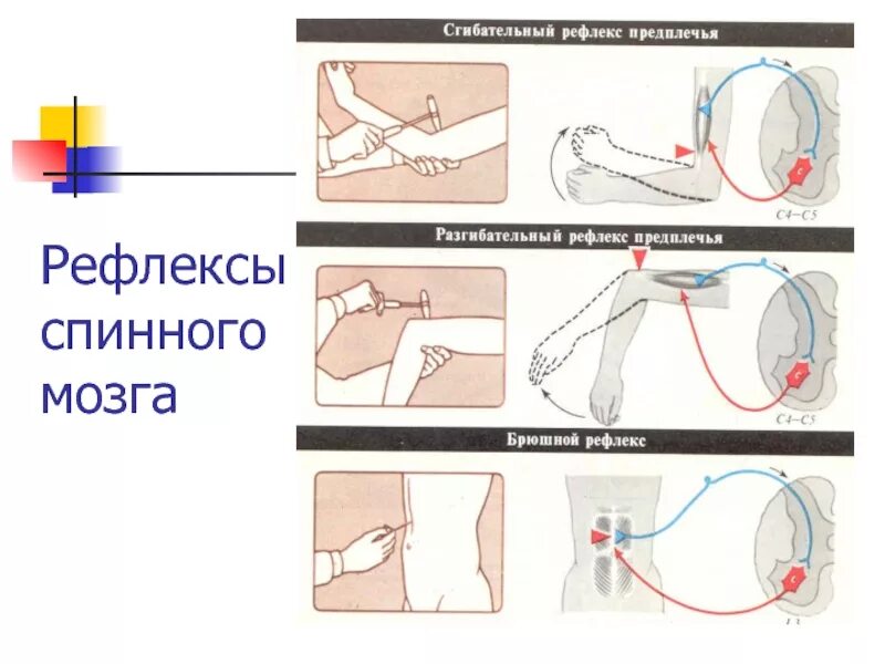 Рефлекс плеча. Сгибательный рефлекс спинного мозга. Сгибательный рефлекс физиология. Сгибательные рефлексы спинного мозга. Рефлекс сухожилия двуглавой мышцы.