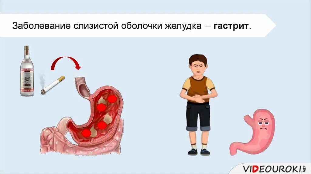 Заболевания органов пищеварения. Болезни системы пищеварения. Заболевание пищеварительной системы гастрит. Презентация на тему заболевания органов пищеварения. Проблемы пищеварительной системы