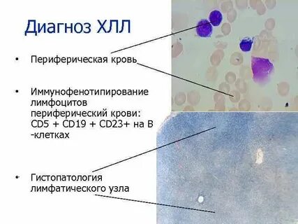 Периферические клетки
