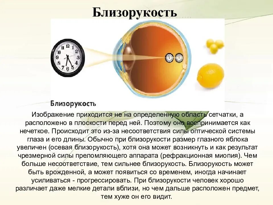 Миопия что это простыми словами. Миопия средней степени одного глаза. Осевая близорукость. Осевая миопия. Близорукость картинки.