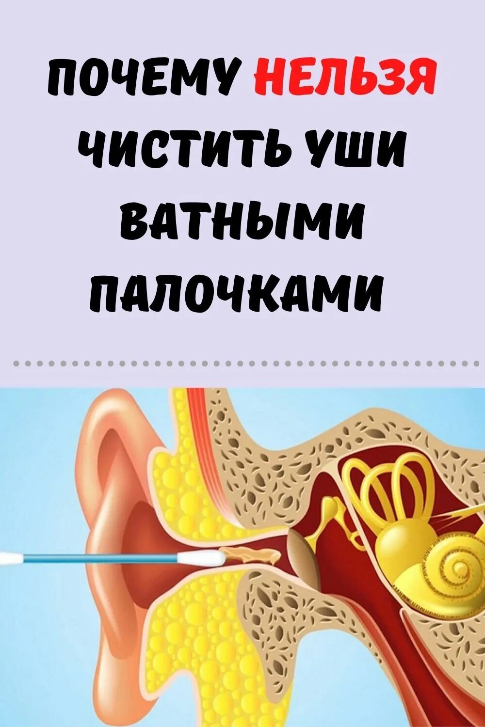 Как правильно чистить уши. Чистить уши ватными палочками. почему нельзя чистить уши. чистка ушей ватными палочками.