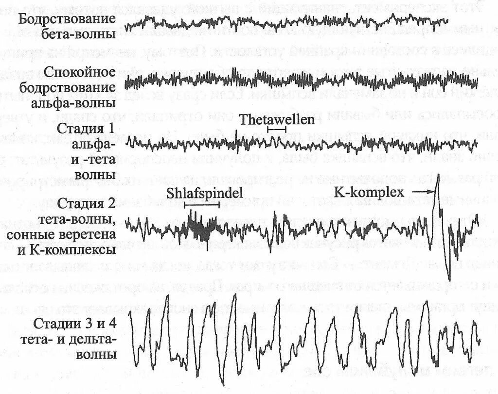 Сонные веретена и к-комплексы на ЭЭГ. Сонные веретена и к-комплексы на ЭЭГ характеризуют. Фазы сна на ЭЭГ. 2 Стадия сна на ЭЭГ.