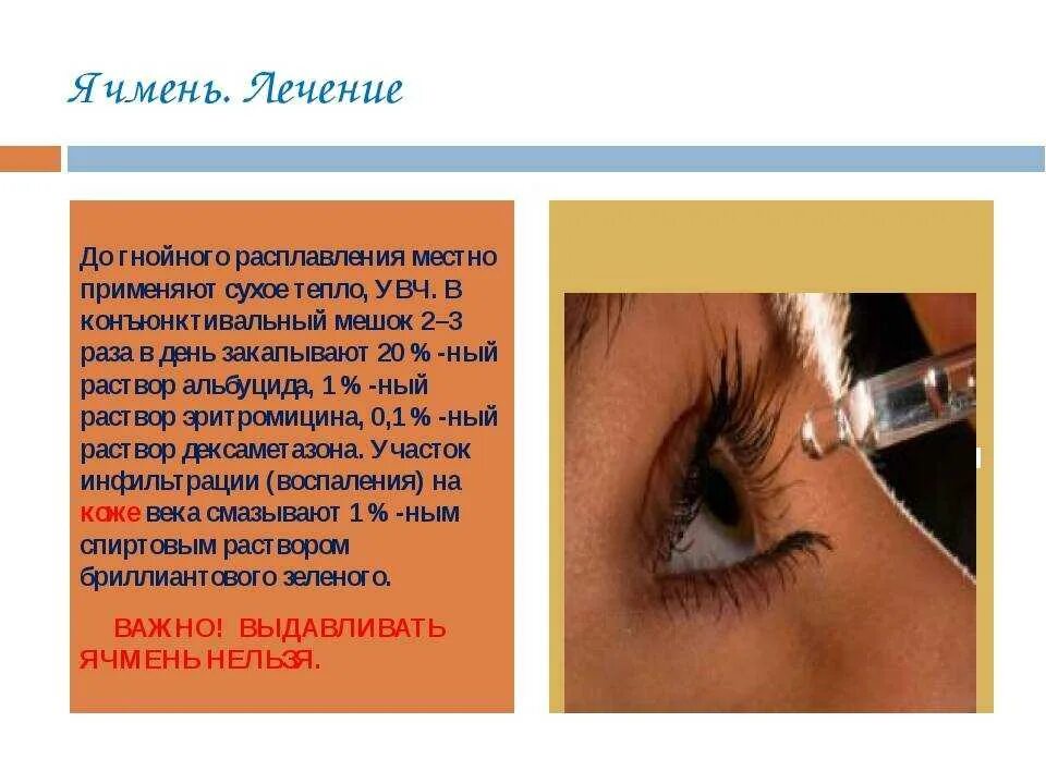 Народное лечение ячменя. Этапы развития ячменя на глазу. Ячмень на глазу у ребенка начальная стадия. Как выглядит ячмень на глазу.