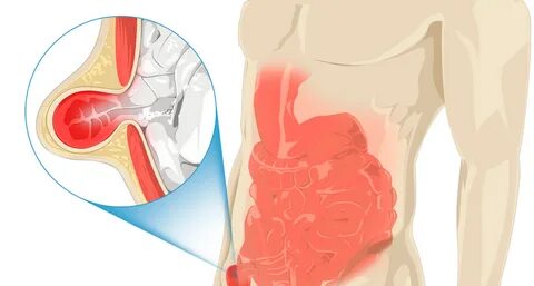 Хирургия в Иркутске в клинике Союз