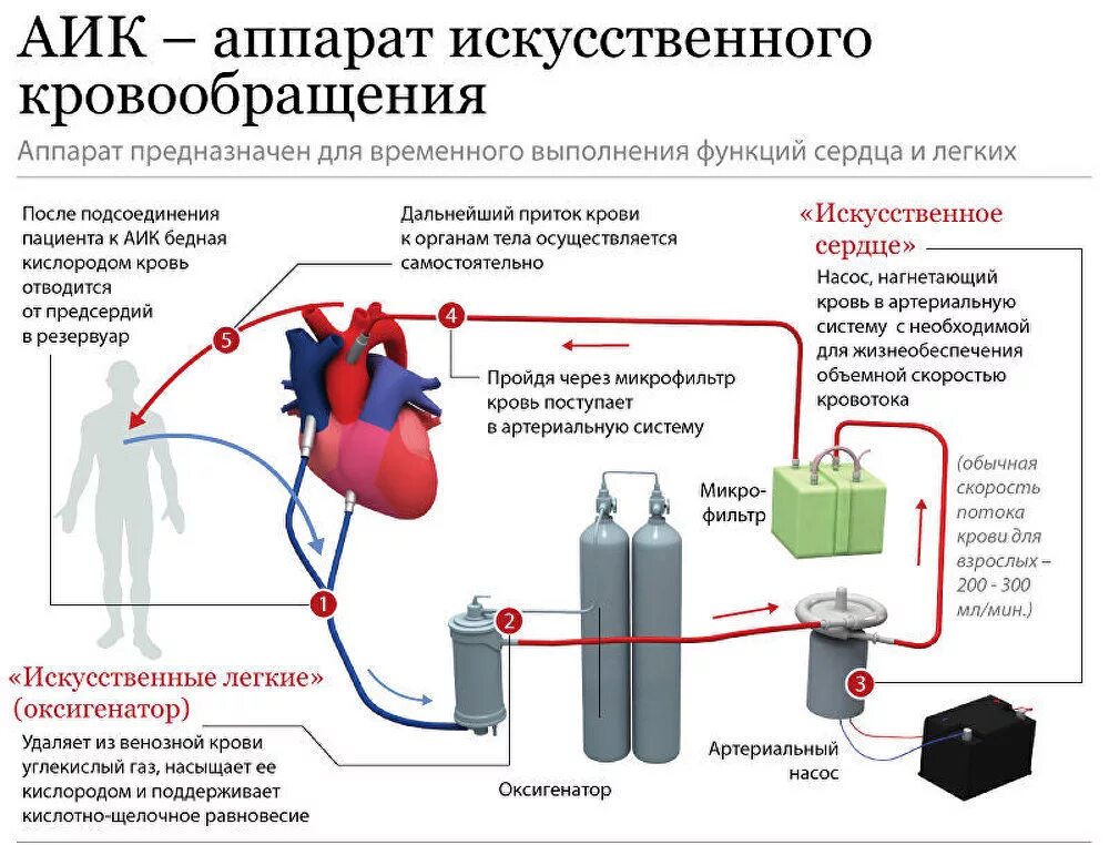 Схема подключения аппарата искусственного кровообращения. Аппарат искусственного кровообращения структурная схема. Аппарат искусственного кровообращения принцип работы схема. АИК аппарат искусственного кровообращения. Отключение кислорода