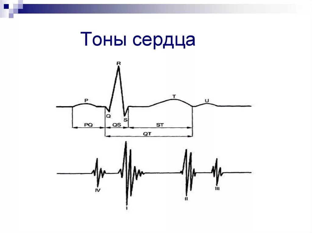 Звуки тона сердца. Тоны сердца 3 тон. Тоны сердца причины возникновения физиология. Тоны сердца в норме и патологии. Громкость тонов сердца в норме.