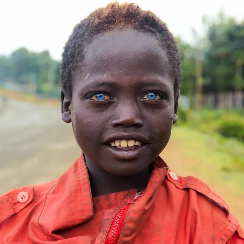 Африканцы негроидная раса. Чернокожие с голубыми глазами. Африканка с голубыми глазами. Эфиопы с голубыми глазами. Глаза негритянки