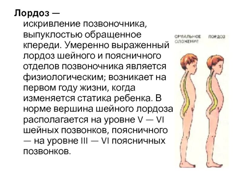 Что значит нарушение статики позвоночника. Искривление позвоночника лордоз. искривление шейного позвоночника. искривление шейного лордоза. физиологический лордоз шейного отдела.