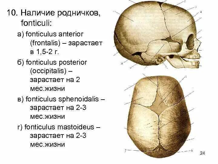 Роднички черепа анатомия. Швы и роднички черепа анатомия. Роднички черепа новорожденного. Топография черепа роднички. Кости родничков