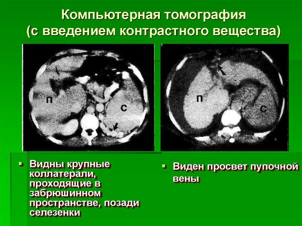 Вредно ли кт