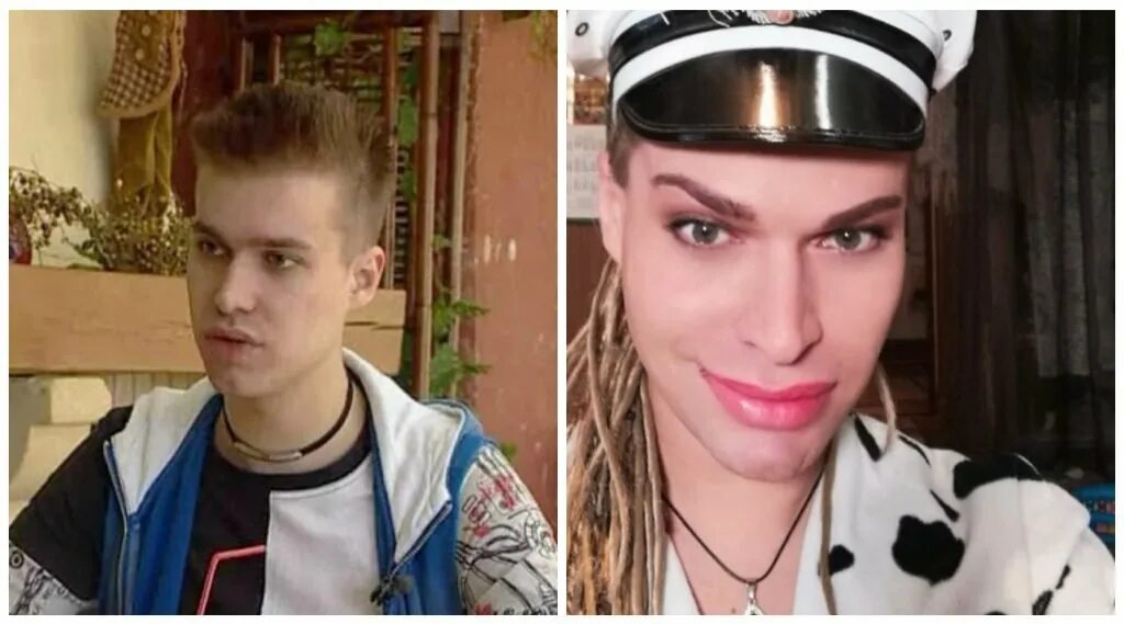 Гоген солнцев фото до и после пластики Солнцев Гоген и его жена после пластики 300 экспертов.РУ
