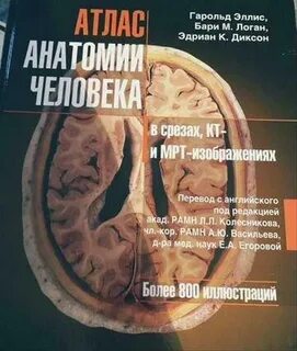 Мрт и кт атлас