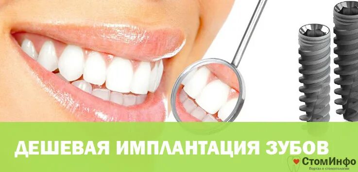 Где сделать зубы в рассрочку. Самый дешёвый имплант зуба. самый дешёвый зубной имплант. вставить зубы в рассрочку. импланты зубов в рассрочку.