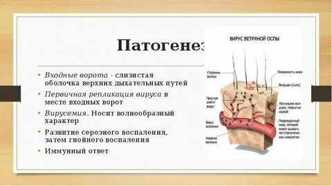 Патогенез ветряной оспы