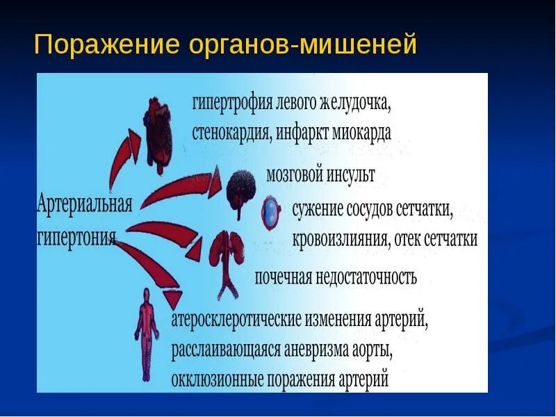 5 органы мишени. Поражение органов мишеней. Органы мишени артериальной гипертензии. Гипертония органы мишени. Артериальная гипертензия поражение органов мишеней.