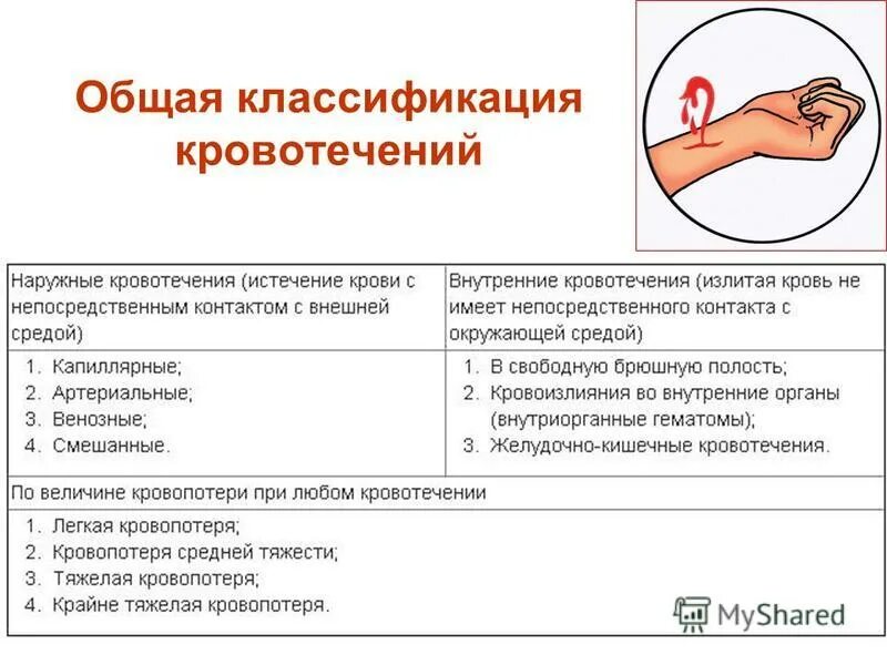 Тест определите кровотечение. Классификация наружных кровотечений. Внутрибрюшное кровотечение классификация. Таблица наружного кровотечения. Классификация артериальных кровотечений.