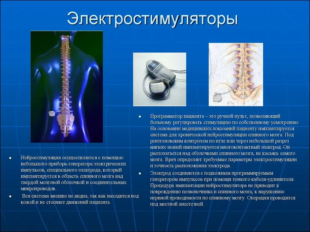 Спинной форум. Хронической эпидуральной стимуляции спинного мозга. Электростимулятор спинного мозга. Стимуляция спинного мозга электродами. Электроды нейростимулятора спинного мозга.