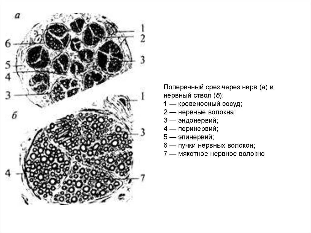 Строение нерва рисунок. Нерв поперечный срез строение. Поперечный разрез периферического нерва препарат. Нервное волокно на срезе гистология. Поперечный срез через нерв.