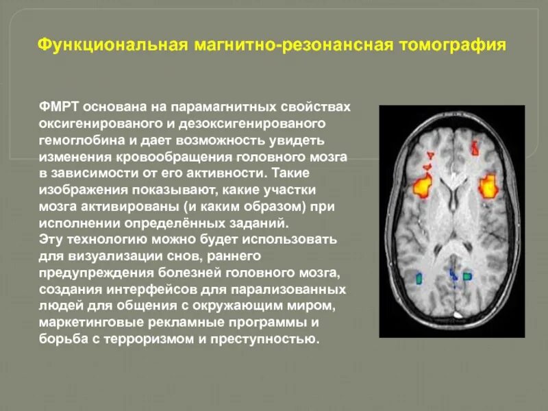 Диффузная активность головного мозга. Функциональная томография головного мозга. функциональная магнитно-резонансная томография. функциональная мрт мозга. функциональная мрт (фмрт).