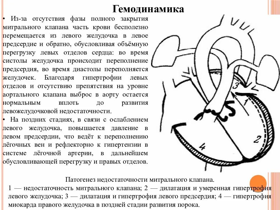 Сердечная недостаточность митрального клапана. Гемодинамика при врожденных пороках сердца схема. Митральный стеноз гемодинамика схема. Порок сердца левого митрального клапана. Гемодинамические расстройства при врожденных пороках сердца..