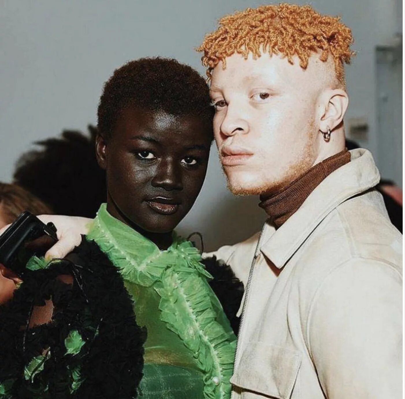 Сами удивительных людей. Афроамериканец альбинос Лео. Люди с необычной внешностью. Необычные афроамериканцы. Необычные негры.