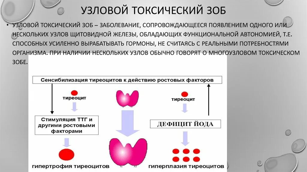 Диффузный токсический зоб гормоны. Этиология зоба щитовидной железы. Многоузловой зоб патогенез. Узловой и многоузловой токсический зоб. Узловой токсический зоб.