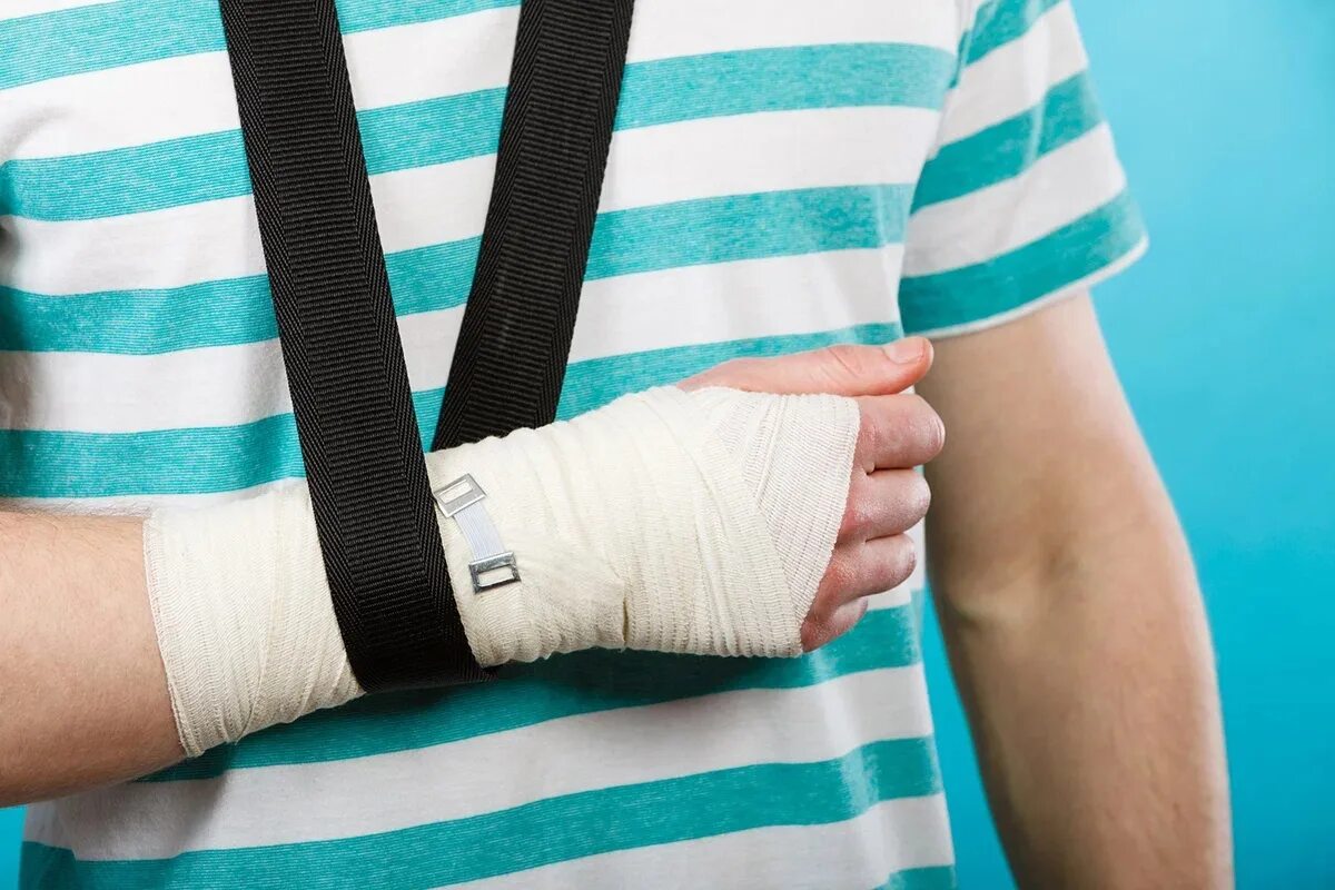 Сильный ушиб первая помощь. Бинтовая повязка на руку. Перевязки при переломах. Повязка на руку при переломе.