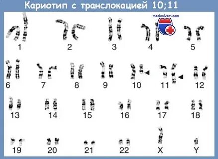 Кариотип яблони