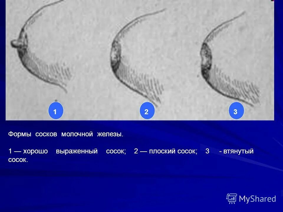 Хорошо выраженный. Хорошо выраженный. Резец вестибулярная поверхность зуба. Автоматия гладких мышц ее механизм физиология. Классификация атрофии беззубых челюстей по шредеру.
