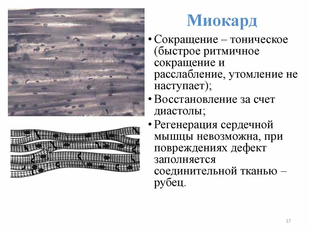 Поперечнополосатая мышечная ткань сердца. Поперечно полосатая сердечная мышечная ткань миокард. Поперечно полосатая сердечная мышечная ткань препарат миокарда. Миокард (сердечная мышечная ткань) (Железный гематоксилин).. Сердечная поперечнополосатая мышечная ткань миокард лошади.