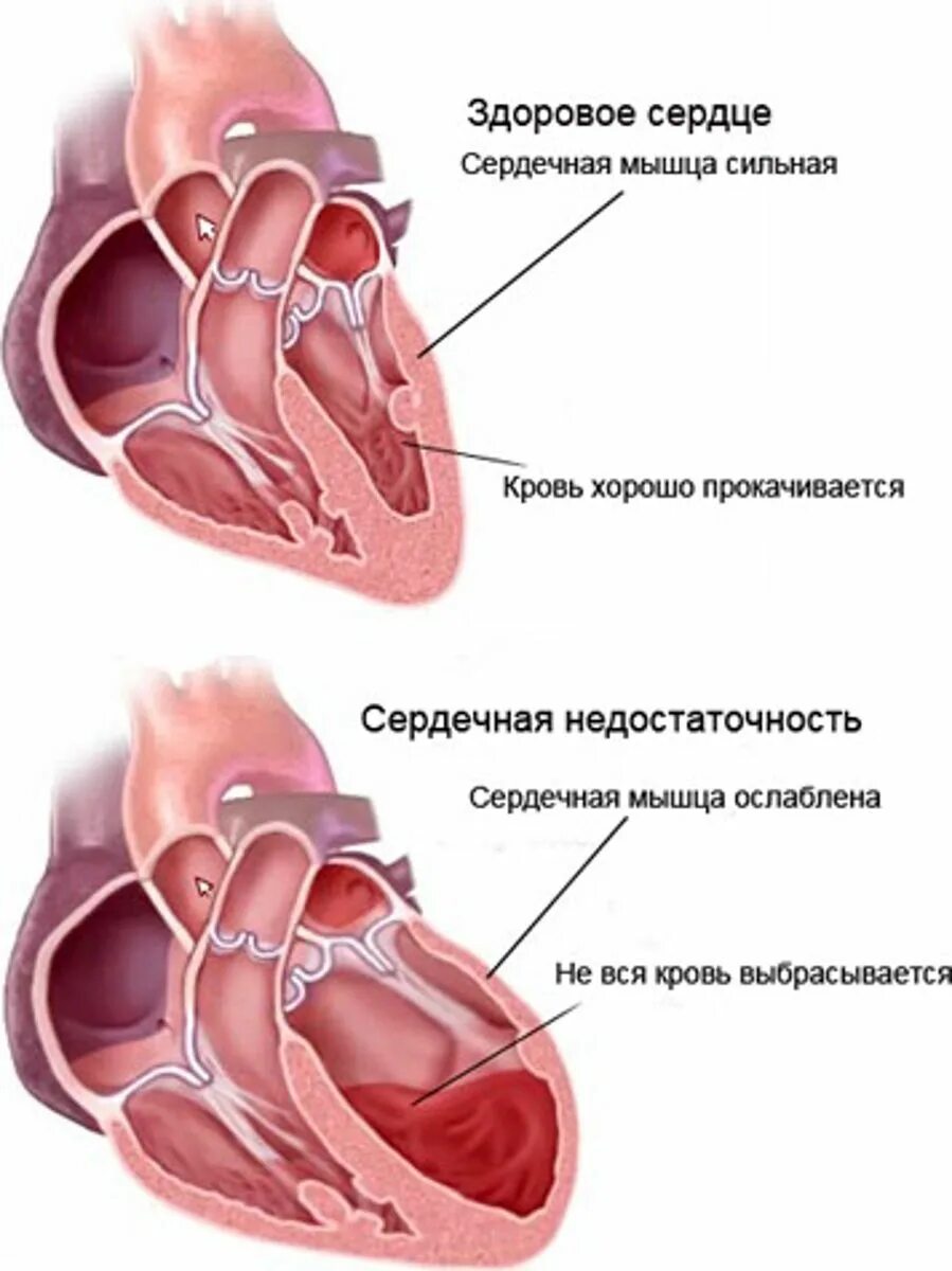 Ситуация сердца