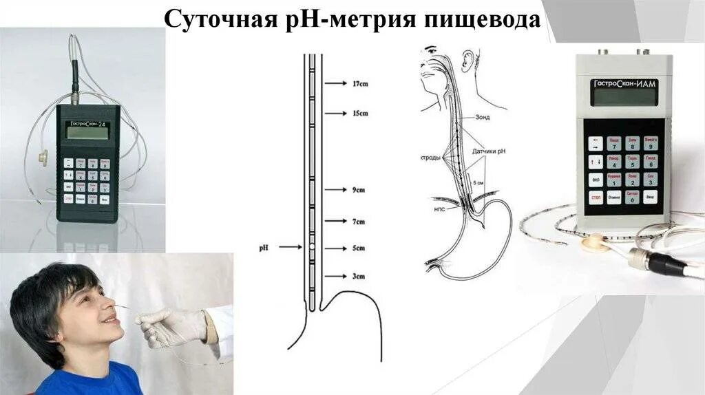 Кислотность пищевода. Суточная РН-метрия пищевода. Суточная PH импедансометрия пищевода. 24 Часовая PH метрия пищевода. Внутрипищеводная РН-метрия (суточный РН-мониторинг).