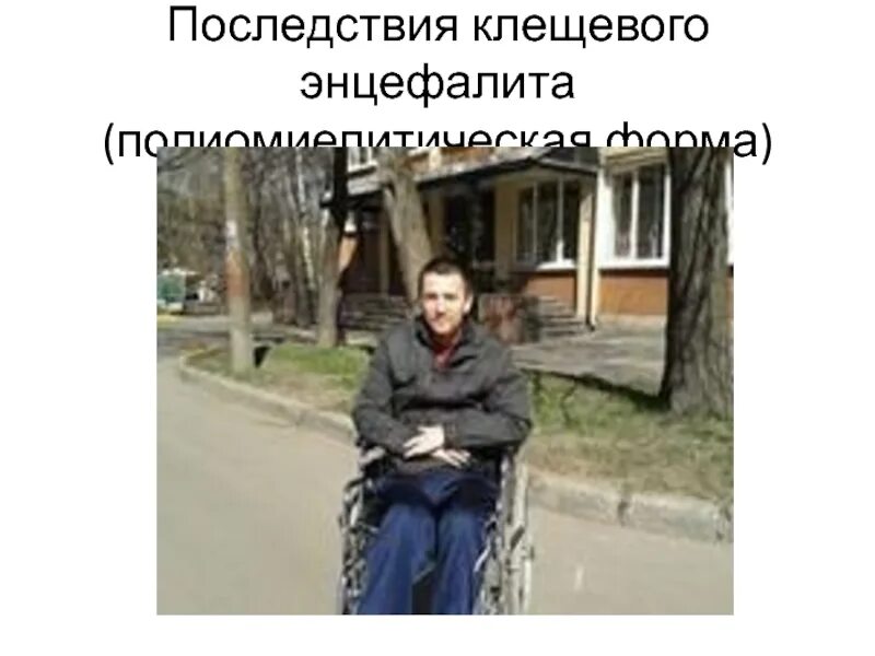 Последствия клещевого энцефалита у человека фото Последствия клещевого энцефалита у человека фото