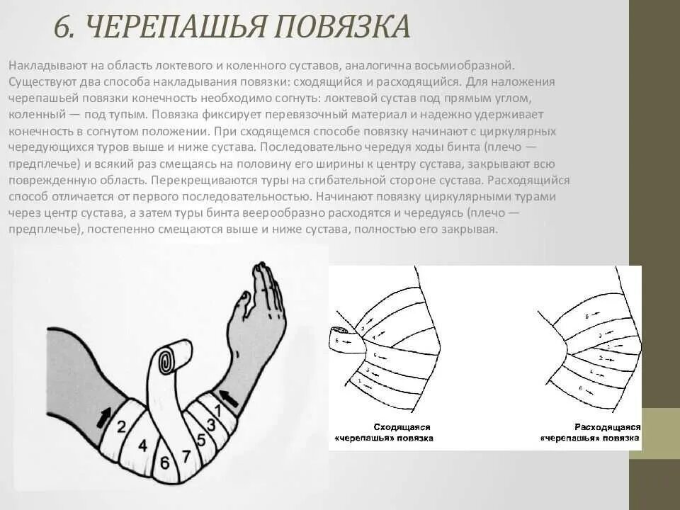 Черепашья повязка алгоритм. Черепашья повязка сходящаяся и расходящаяся. черепашья повязка повязка. черепашья сходящаяся повязка алгоритм. черепашья повязка техника наложения.