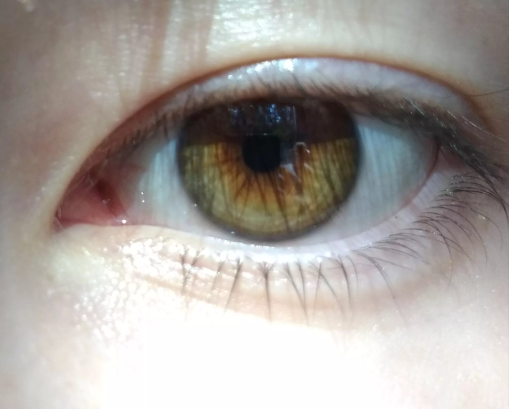Зеленые глаза становятся карими