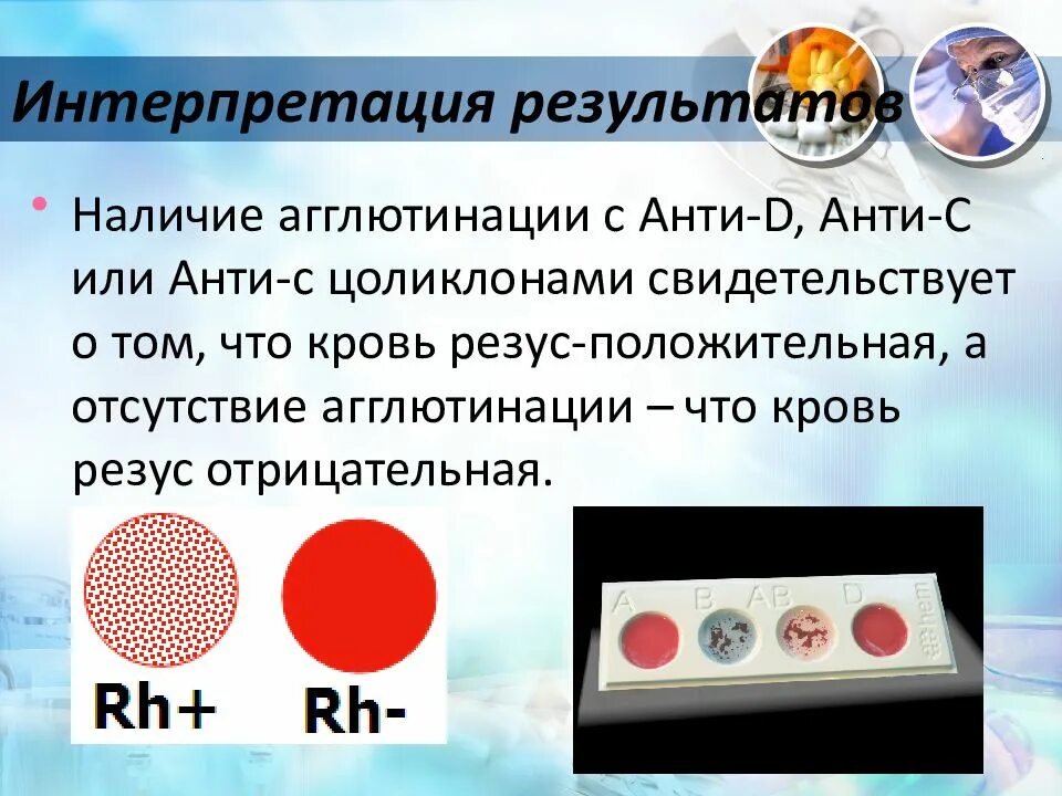 Алгоритм определения резус фактора. Реакция агглютинации для определения резус фактора. методика определения резус-фактора цоликлоном анти-d. группа крови и резус фактор цоликлоны. набор для определения группы крови и резус фактора по цоликлонам.