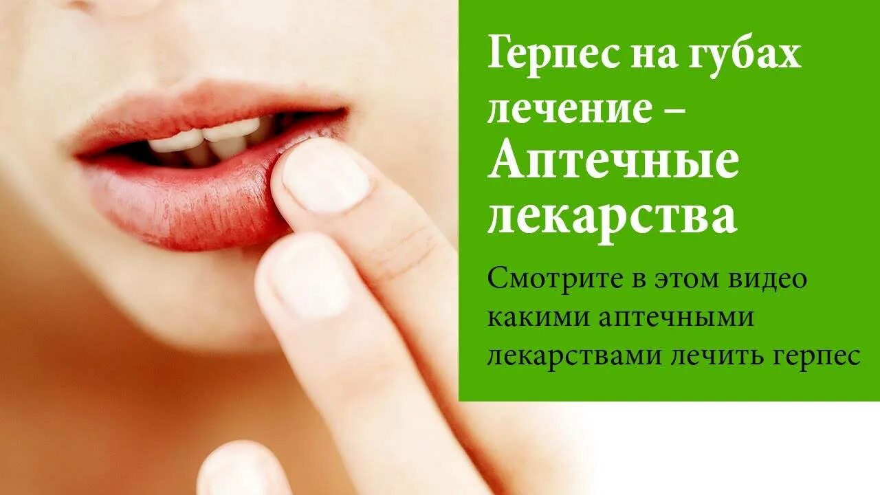 Герпес как быстро вылечить за 1 день. Герпес на гуюахлечение.