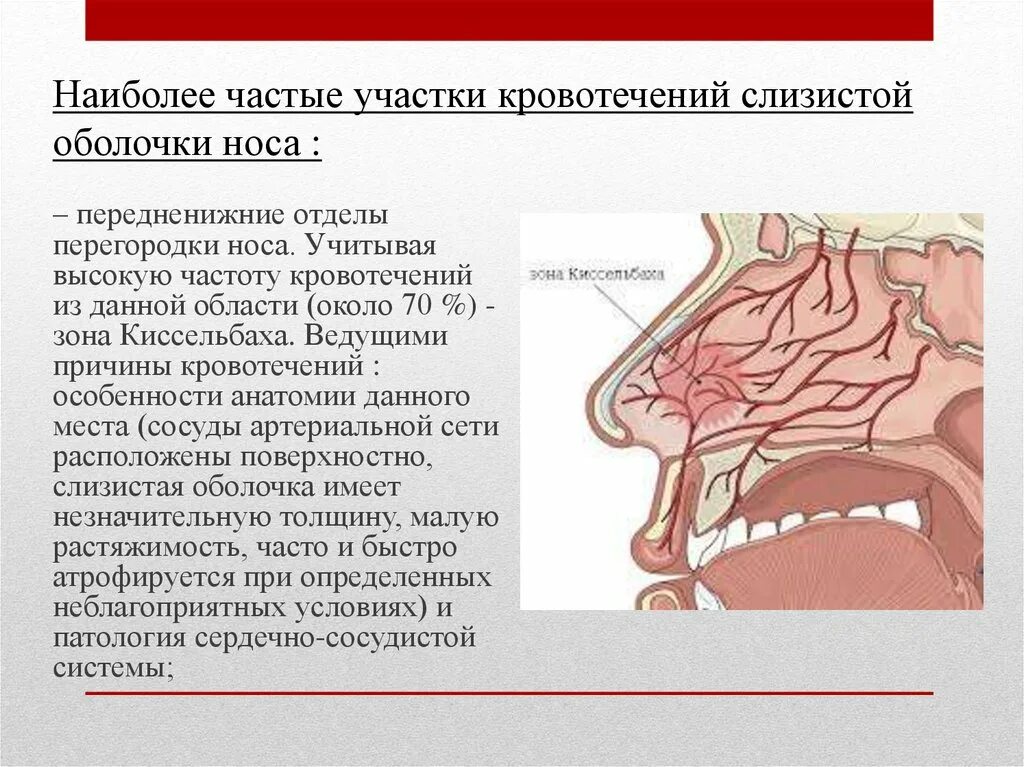 Локализация слизистой оболочки. Носовые кровотечения зона Киссельбаха. Расширение сосудов в зоне Киссельбаха. Сосудистое сплетение Киссельбаха. Сосуды зоны Киссельбаха.