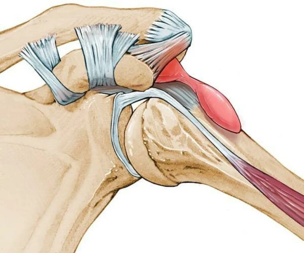Травма связок сустава. Импиджмент субакромиальный. Импинджмент синдром плечевого сустава. Субакромиального импинджмент что.это.