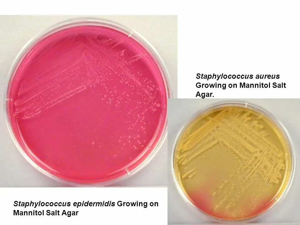 Маннитол солевой агар. Маннит солевой агар. Молочно солевой агар стафилококк. Staphylococcus aureus среда