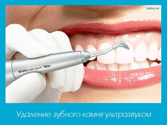 Удалить камни ультразвуком. Удаление зубного камня ультразвуком. профессиональная чистка зубов air flow. удалить зубной камень ультразвуком. уз чистка зубов наконечник.