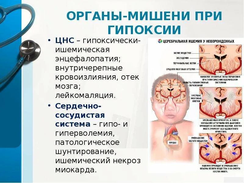 Гипоксия мозга у ребенка. Гипоксия мозга симптомы у взрослого. Гипоксия головного мозга последствия. Гипоксия головного мозга у ребенка.