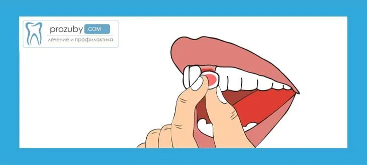 Остановить кровотечение удаления зуба. Выдернули зуб кровь не останавливается.